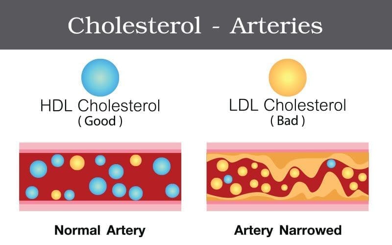 hdl and ldl cholesterol levels